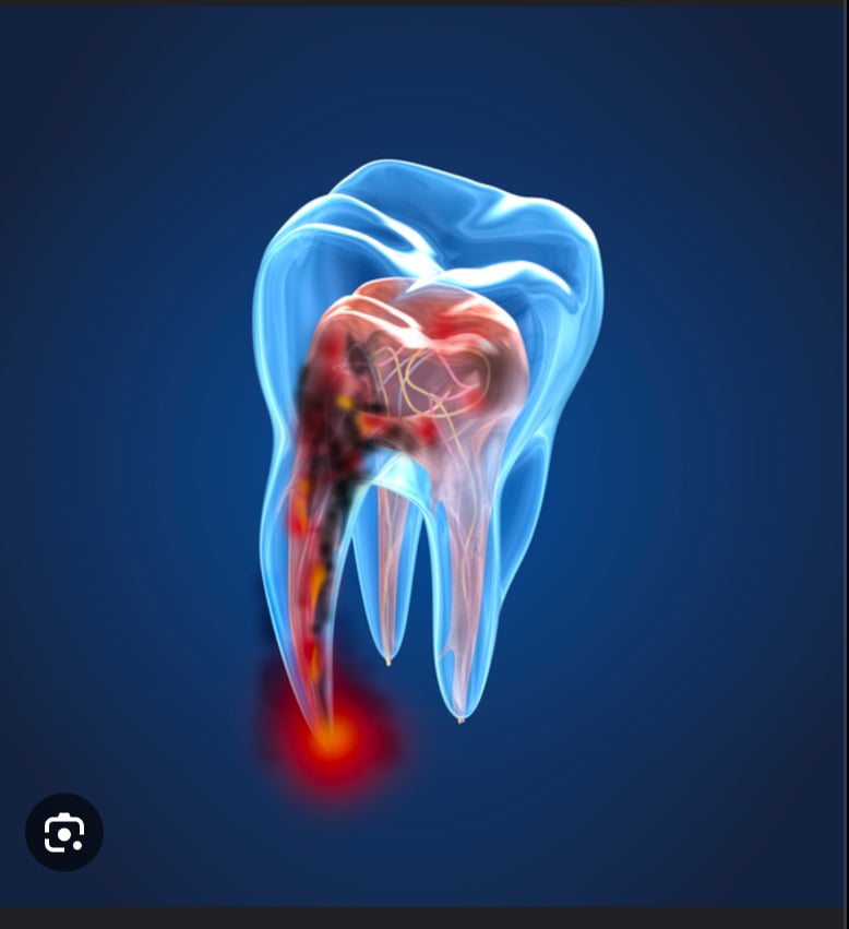 Digital image of a tooth